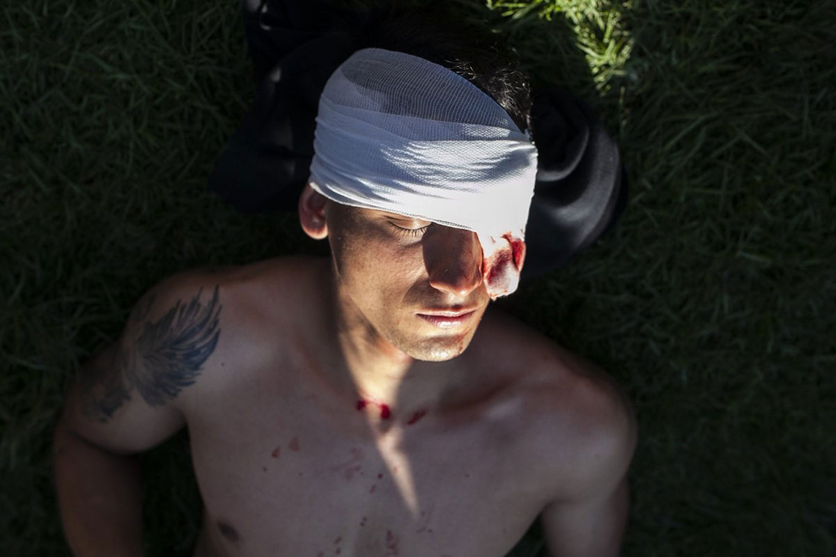 Chile: personal médico pone en duda las cifras oficiales de heridos