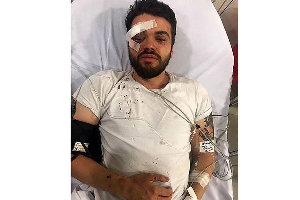 El grupo de agresores reconoció haber golpeado a un joven por su orientación sexual