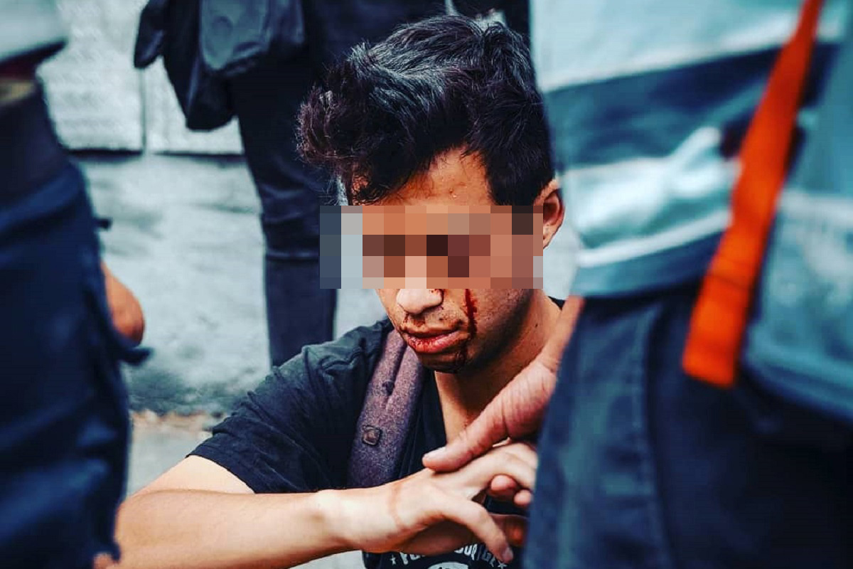 Conmoción por el joven fotógrafo chileno de 21 años que quedó ciego por la represión de los Carabineros
