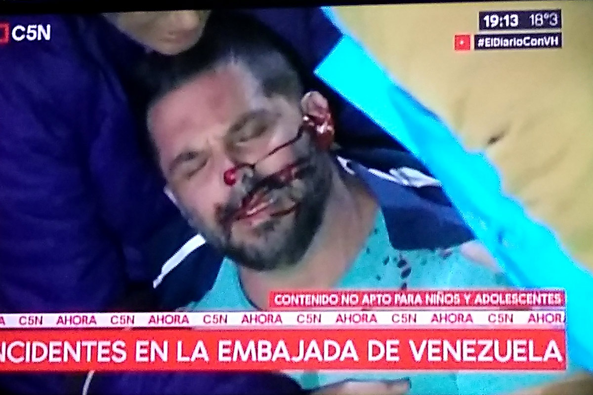 Tensión en Palermo: dos heridos y dos detenidos por incidentes frente a la embajada de Venezuela