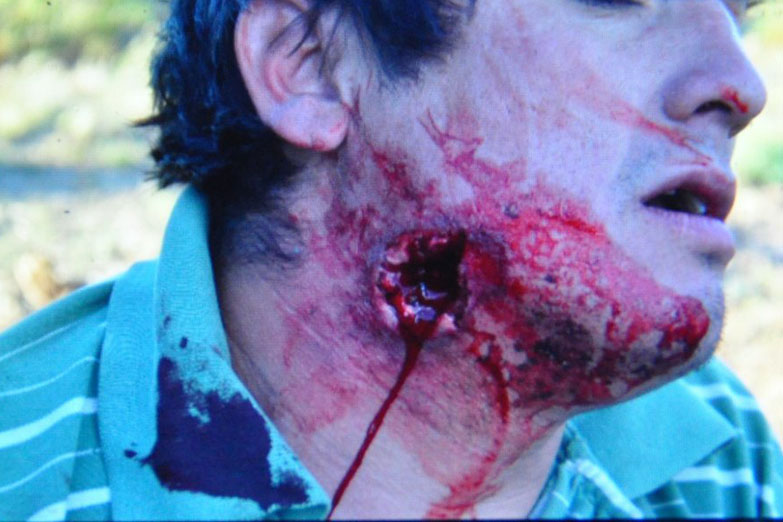Otra brutal represión en Chubut con heridos de bala