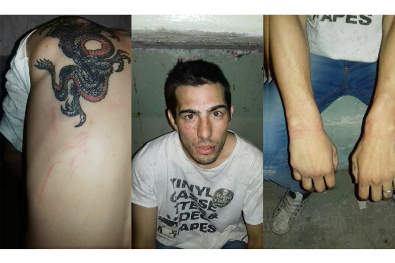 Denuncian a la Bonaerense por golpear y torturar a 3 jóvenes
