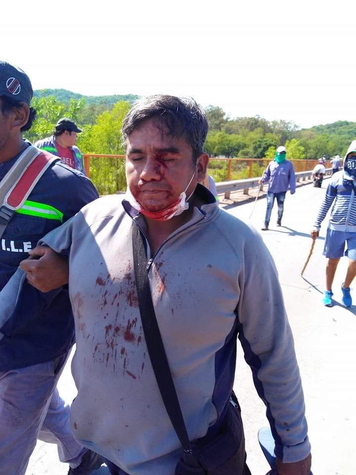 Represión en Jujuy: la policía embistió con gases y balas de goma a trabajadores del ingenio La Esperanza