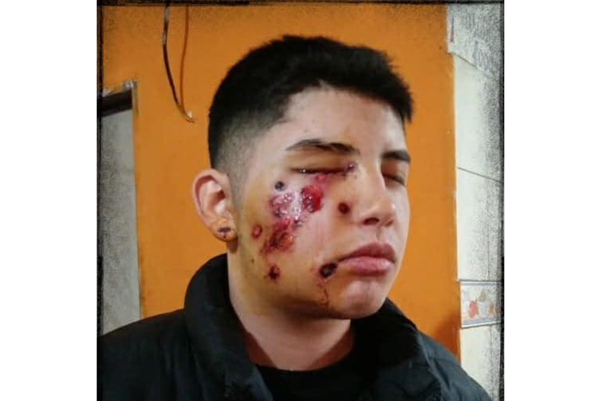 Un grupo especial de la Bonaerense allanó la casa equivocada y le hizo perder el ojo a un menor