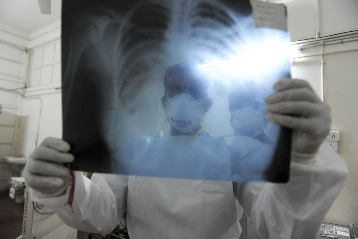 Coronavirus: 198 fallecidos y 8037 contagios en todo el país