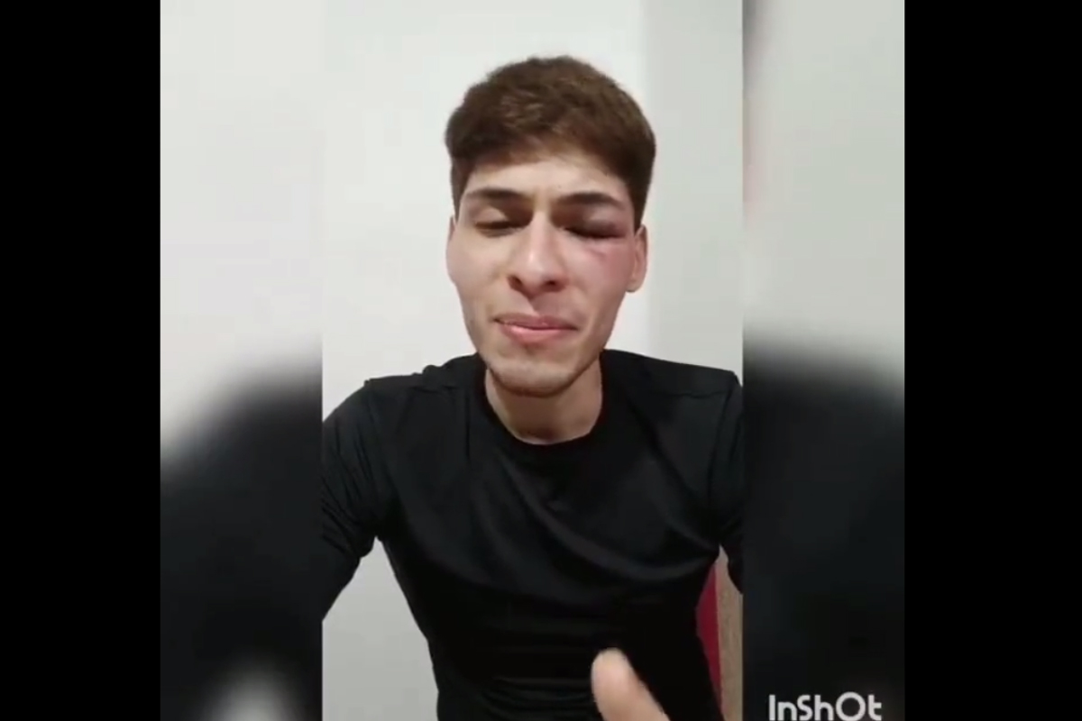 Una persona no binaria y con Síndrome de Asperger sufrió un ataque brutal, que fue repudiado por el presidente