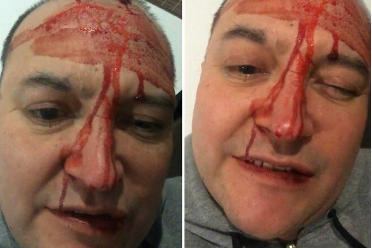 Leo García fue brutalmente golpeado y denunció que se trató de un ataque homofóbico