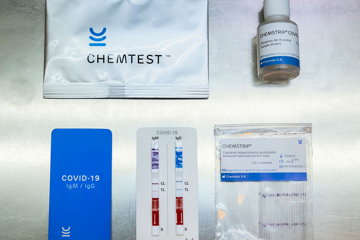 Un test para medir anticuerpos contra Covid–19 y otro para diagnosticarlo: los dos desarrollos aprobados por la Anmat