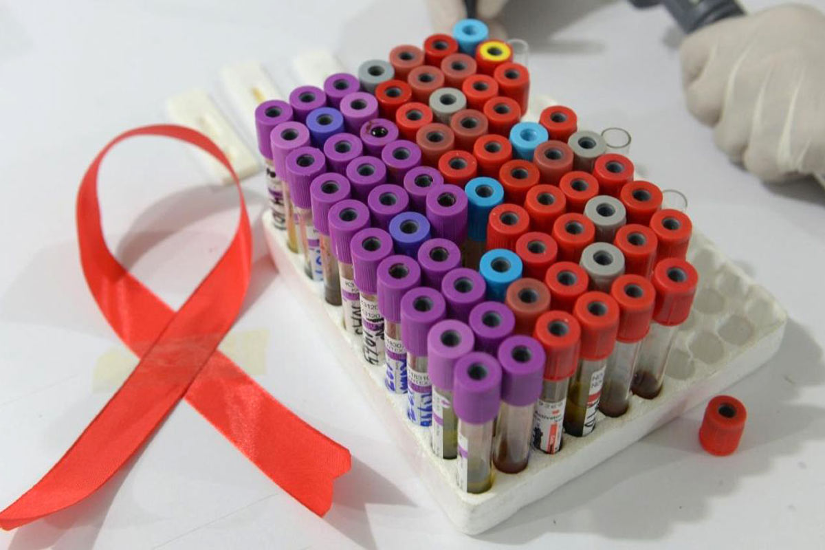 Por primera vez, una mujer fue curada de VIH gracias a un trasplante de células madre