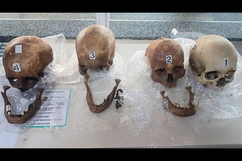 Aduana secuestró cuatro cráneos humanos en el equipaje de una pasajera de Paraguay