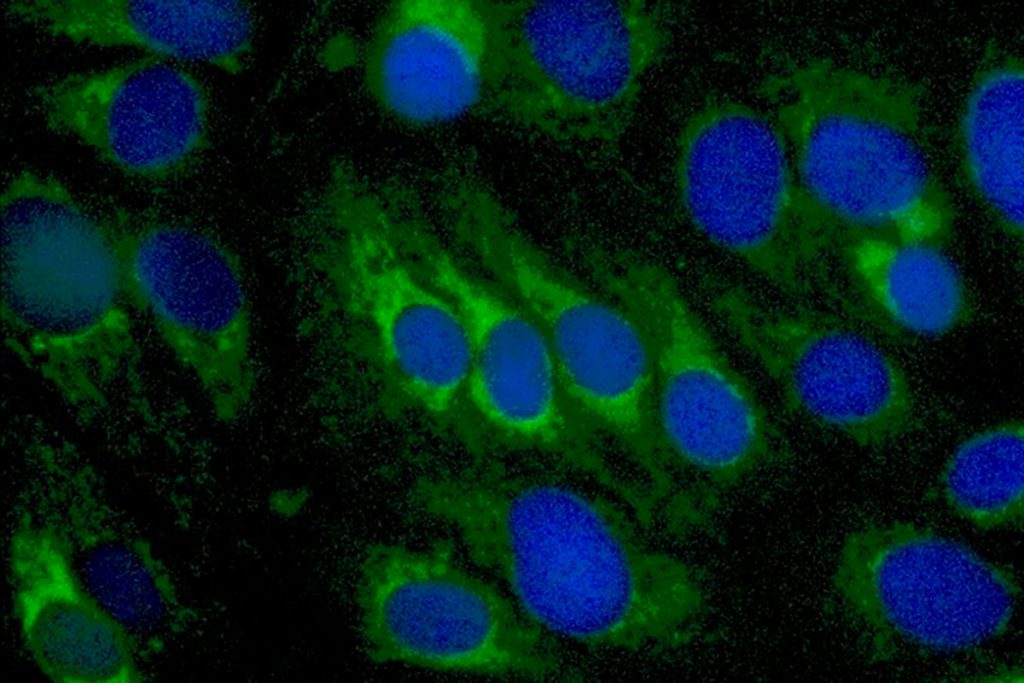 Usan un antipsicótico para combatir el virus del dengue 2 Usan un antipsicótico para combatir el virus del dengue