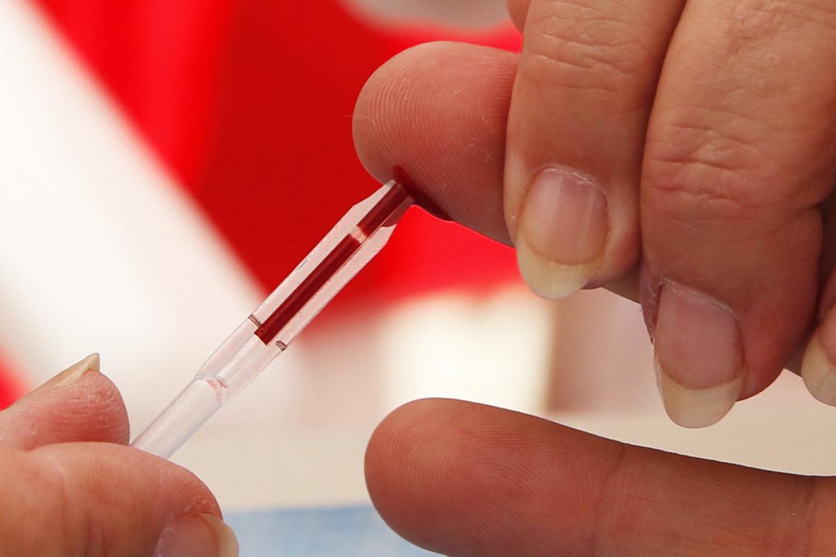Testeos gratuitos de VIH y otras ITS en todo el país por el Día Mundial del Sida