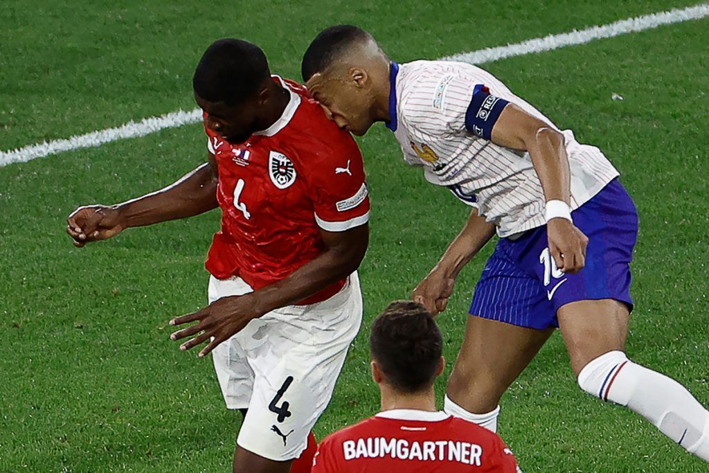 Mbappé se fracturó la nariz, pero sigue en la Copa: ¿Jugará con mascarilla de tortuga ninja? 1 Mbappé se fracturó la nariz, pero sigue en la Copa: ¿Jugará con mascarilla de tortuga ninja?