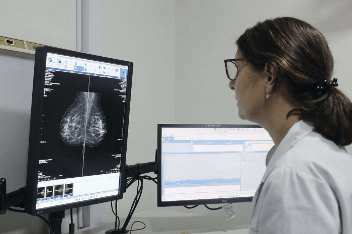 Decisión histórica: en la Provincia de Buenos Aires se comenzará a indicar la mamografía a partir de los 40 años