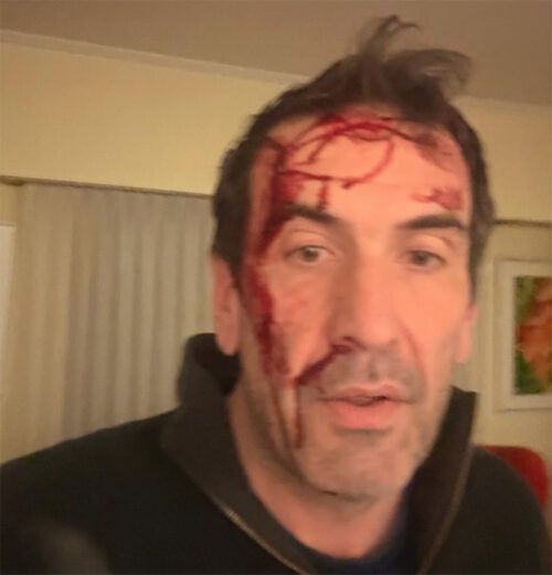 Violento asalto en Neuquén al diputado y candidato a senador Pablo Cervi