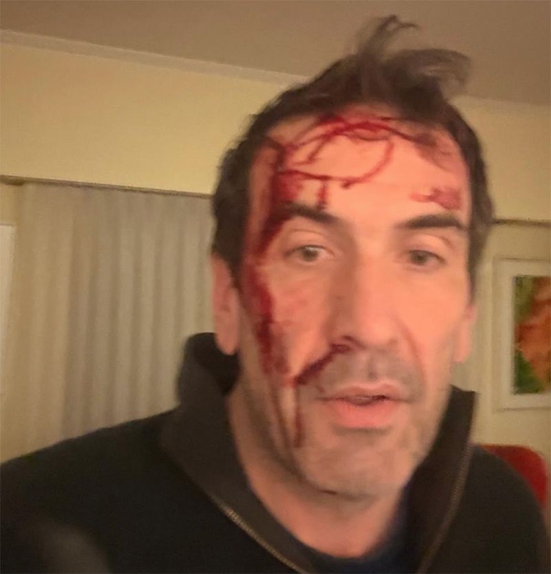 Violento asalto en Neuquén al diputado y candidato a senador Pablo Cervi