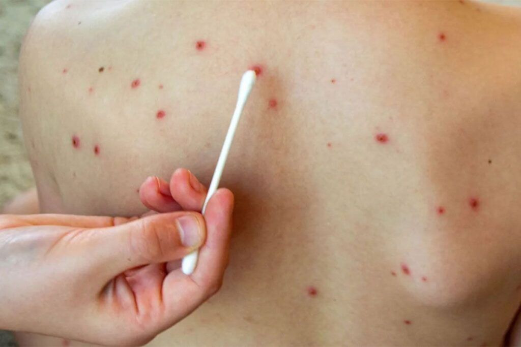 Las peligrosas similitudes entre las políticas sanitarias de Argentina y Estados Unidos que fomentan la antivacunación