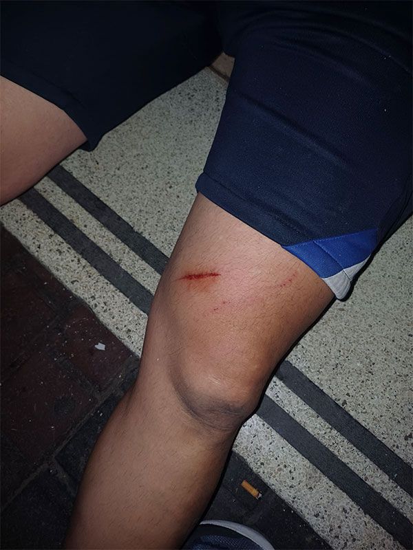 Protestas contra la megaminería: la policía provincial reprimió y detuvo manifestantes en la Capital y Godoy Cruz 2 Protestas contra la megaminería: la policía provincial reprimió y detuvo manifestantes en la Capital y Godoy Cruz