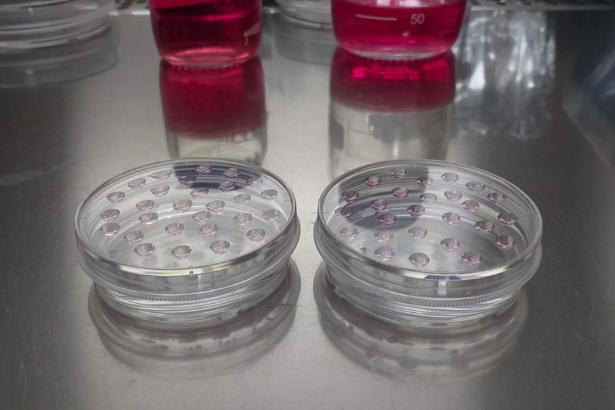 Cómo un plaguicida puede afectar el tratamiento del cáncer de mama