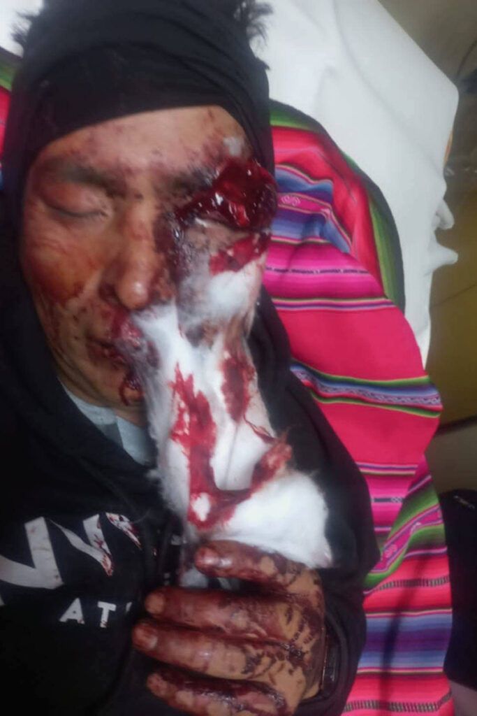 Crisis boliviana: gases, dinamita y el fantasma de la militarización para sostener el plan de Rodrigo Paz 2 Crisis boliviana: gases, dinamita y el fantasma de la militarización para sostener el plan de Rodrigo Paz